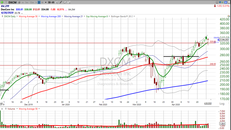 Here's what i think about DexCom ($DXCM) (April 28, 2020)