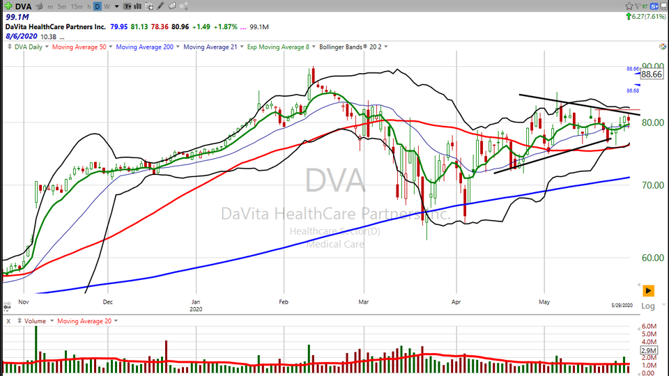 Here's how I traded Davita ($DVA), and how I will be trading it next week. (June 05, 2020)