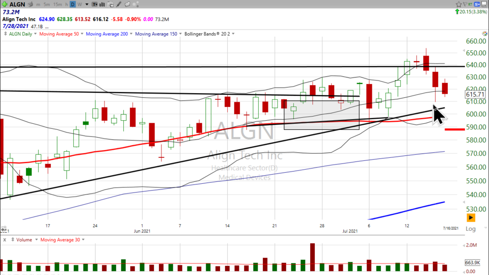 Want to straighten out your account?  Try Align Tech ($ALGN) (July 20, 2021)