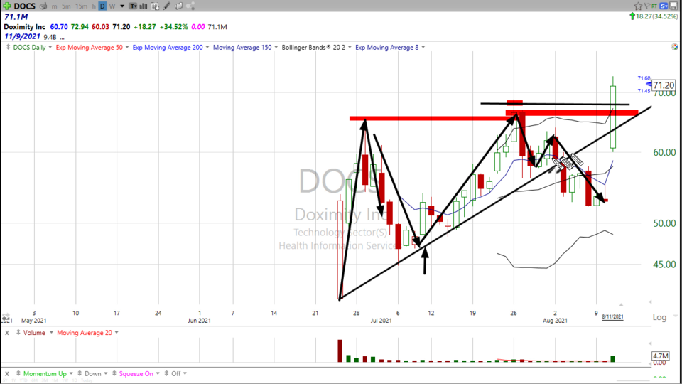 Here's how I'm trading Doximity ($DOCS) - August 11, 2021